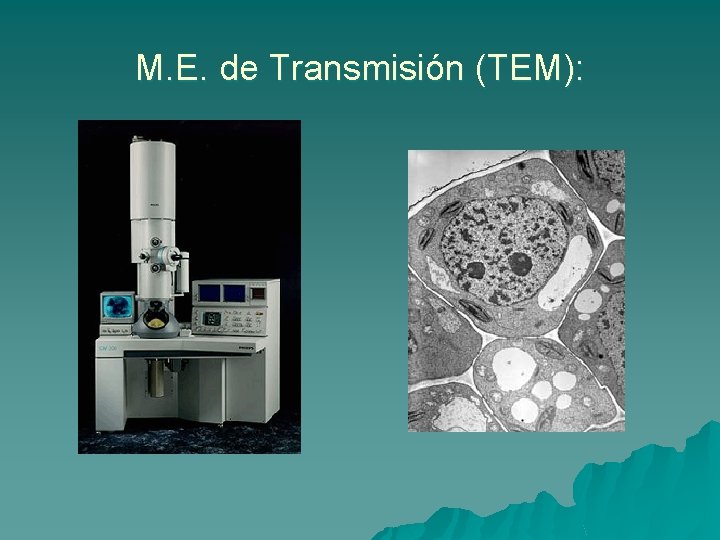 M. E. de Transmisión (TEM): 