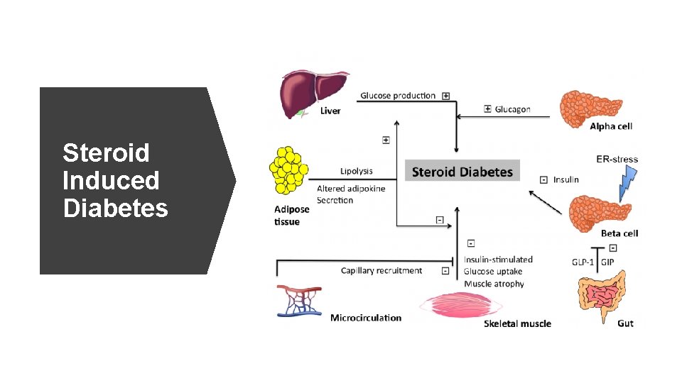 Steroid Induced Diabetes 