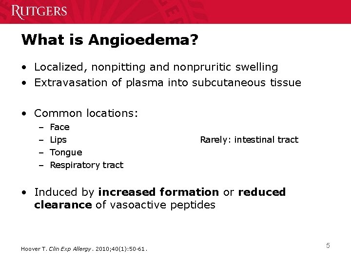 What is Angioedema? • Localized, nonpitting and nonpruritic swelling • Extravasation of plasma into