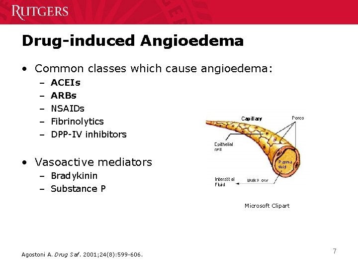 Drug-induced Angioedema • Common classes which cause angioedema: – – – ACEIs ARBs NSAIDs