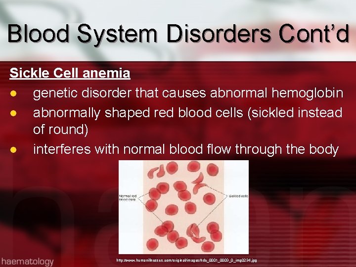 Blood System Disorders Cont’d Sickle Cell anemia l genetic disorder that causes abnormal hemoglobin