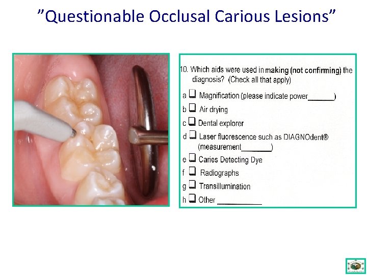 ”Questionable Occlusal Carious Lesions” 