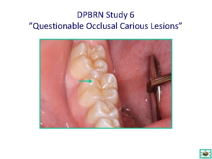 DPBRN Study 6 ”Questionable Occlusal Carious Lesions” 