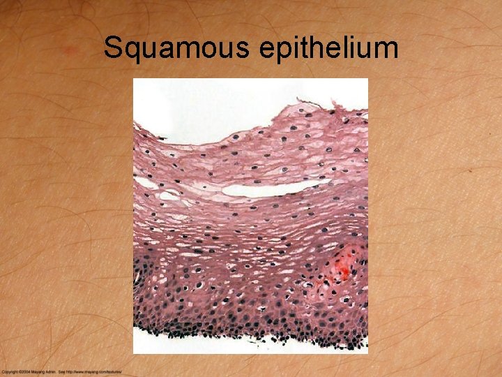 Squamous epithelium 