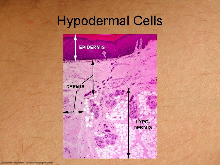 Hypodermal Cells 