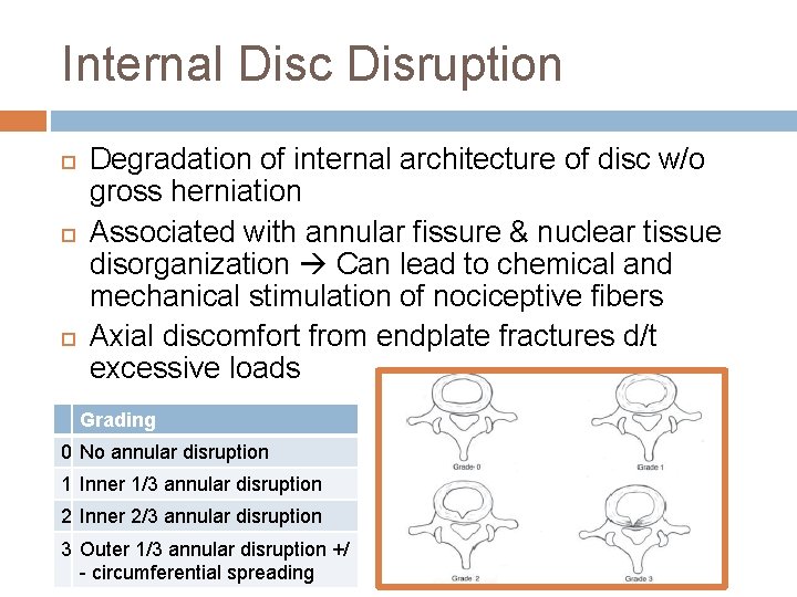 Internal Disc Disruption Degradation of internal architecture of disc w/o gross herniation Associated with