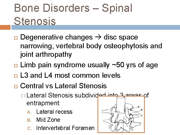 Bone Disorders – Spinal Stenosis Degenerative changes disc space narrowing, vertebral body osteophytosis and