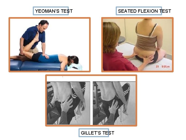 YEOMAN’S TEST SEATED FLEXION TEST GILLET’S TEST 