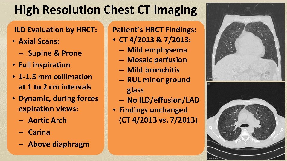 High Resolution Chest CT Imaging ILD Evaluation by HRCT: • Axial Scans: – Supine