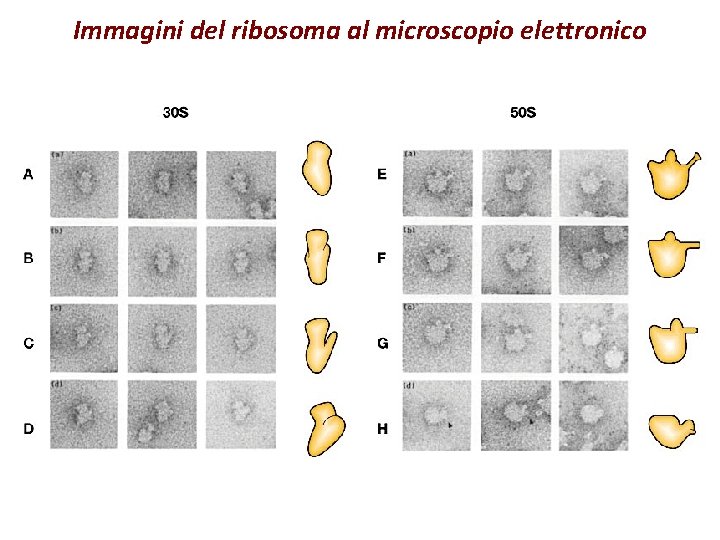 Immagini del ribosoma al microscopio elettronico 