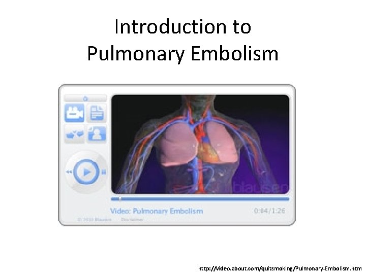 Introduction to Pulmonary Embolism http: //video. about. com/quitsmoking/Pulmonary-Embolism. htm 