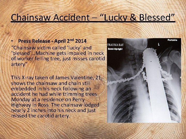 Chainsaw Accident – “Lucky & Blessed” • Press Release - April 2 nd 2014