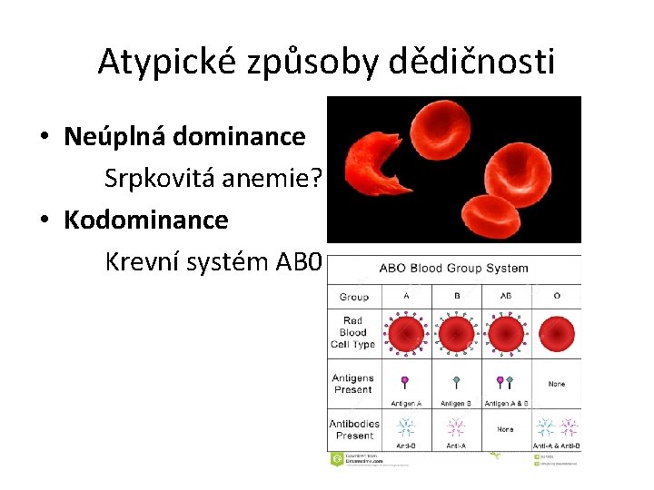 Atypické způsoby dědičnosti • Neúplná dominance Srpkovitá anemie? • Kodominance Krevní systém AB 0