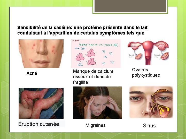 Sensibilité de la caséine: une protéine présente dans le lait conduisant à l’apparition de