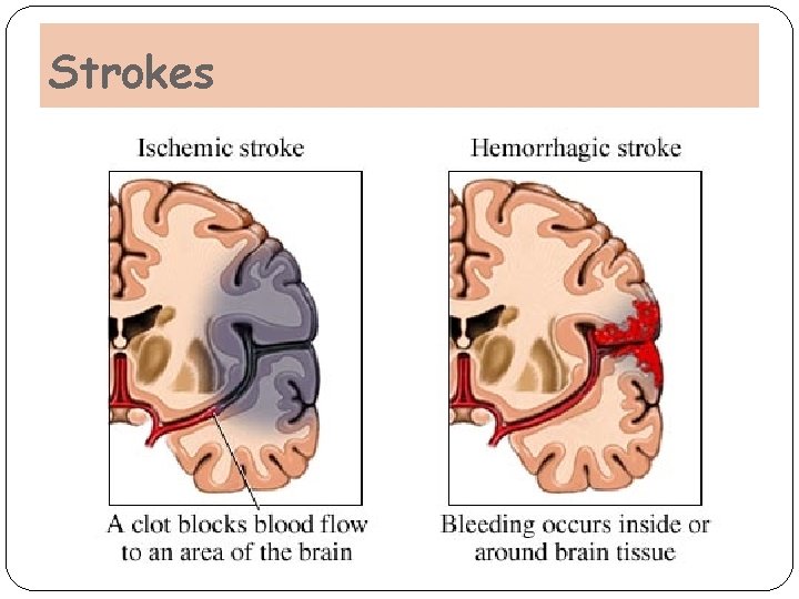 Strokes Strokes