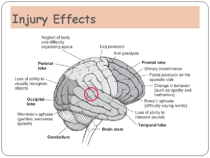 Injury Effects Injury Effects