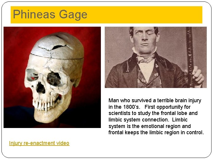 Phineas Gage Man who survived a terrible brain injury in the 1800’s. First opportunity Phineas Gage Man who survived a terrible brain injury in the 1800’s. First opportunity