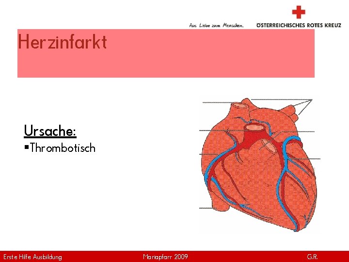 Herzinfarkt Ursache: §Thrombotisch Erste Hilfe. April Ausbildung Version | 2011 Mariapfarr 2009 www. roteskreuz.