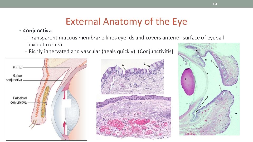 13 External Anatomy of the Eye • Conjunctiva ‒ Transparent mucous membrane lines eyelids