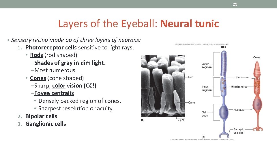 23 Layers of the Eyeball: Neural tunic • Sensory retina made up of three