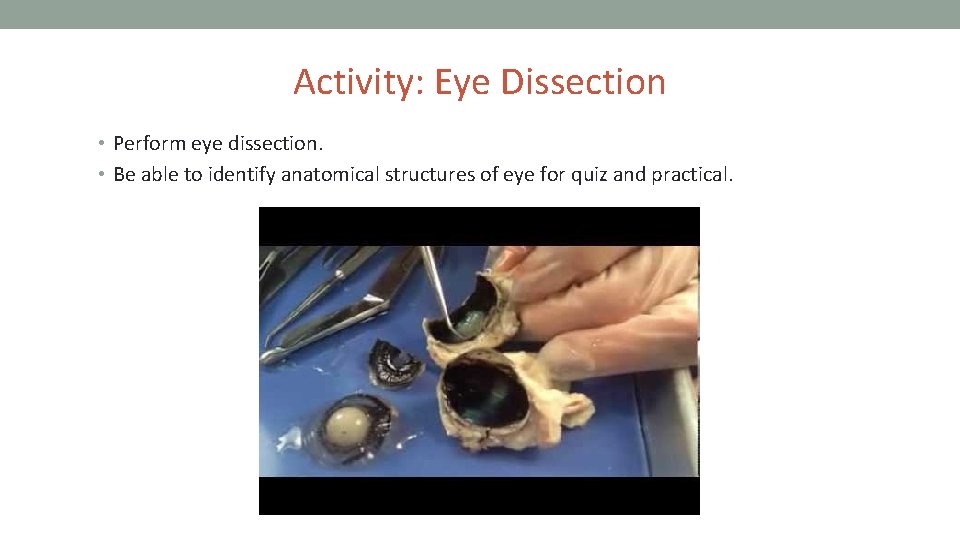 Activity: Eye Dissection • Perform eye dissection. • Be able to identify anatomical structures