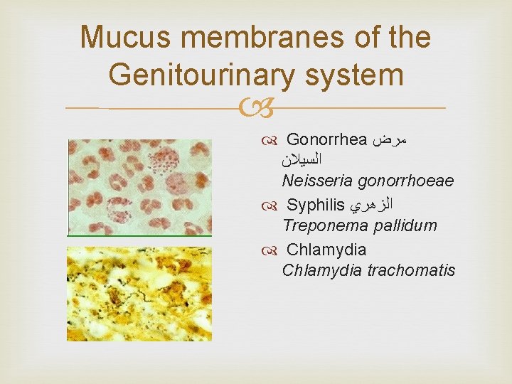 Mucus membranes of the Genitourinary system Gonorrhea ﻣﺮﺽ ﺍﻟﺴﻴﻼﻥ Neisseria gonorrhoeae Syphilis ﺍﻟﺰﻫﺮﻱ Treponema