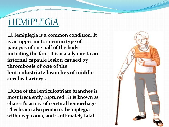 HEMIPLEGIA q. Hemiplegia is a common condition. It is an upper motor neuron type