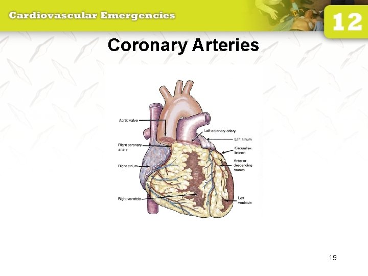 Coronary Arteries 19 