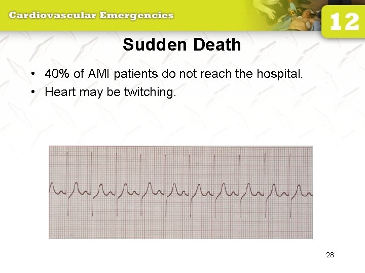 Sudden Death • 40% of AMI patients do not reach the hospital. • Heart