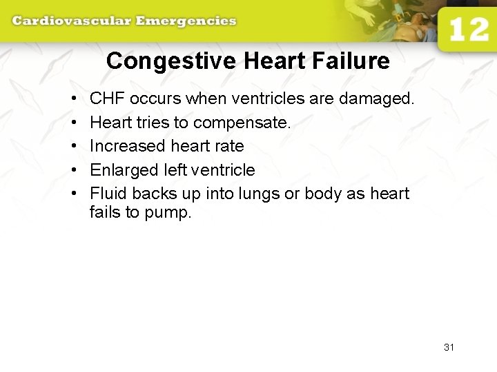Congestive Heart Failure • • • CHF occurs when ventricles are damaged. Heart tries