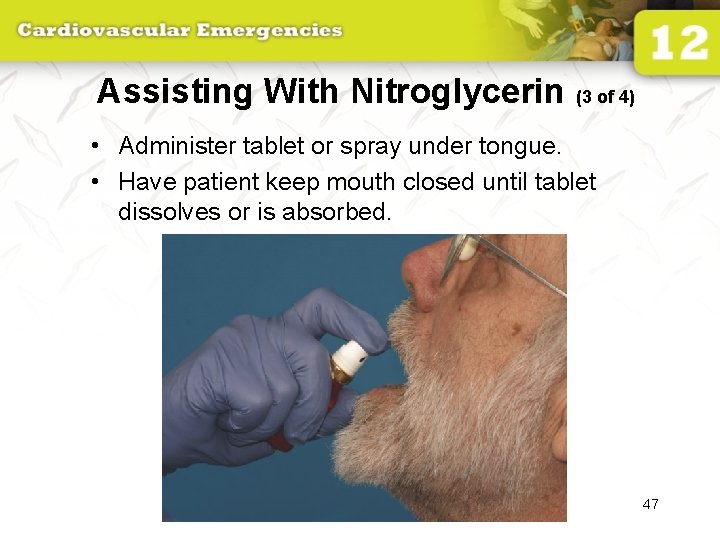 Assisting With Nitroglycerin (3 of 4) • Administer tablet or spray under tongue. •