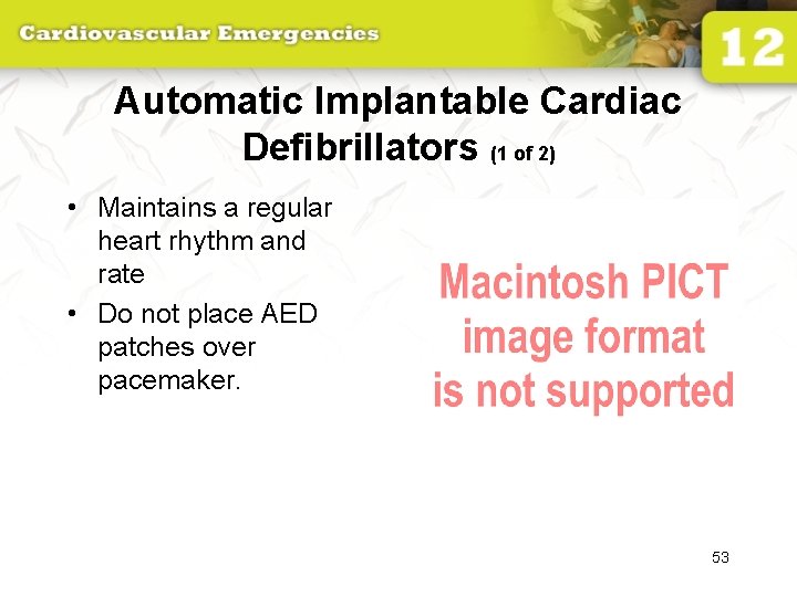 Automatic Implantable Cardiac Defibrillators (1 of 2) • Maintains a regular heart rhythm and