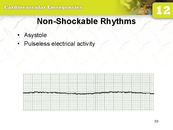 Non-Shockable Rhythms • Asystole • Pulseless electrical activity 59 