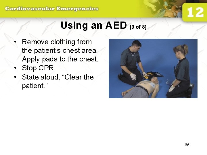 Using an AED (3 of 8) • Remove clothing from the patient’s chest area.