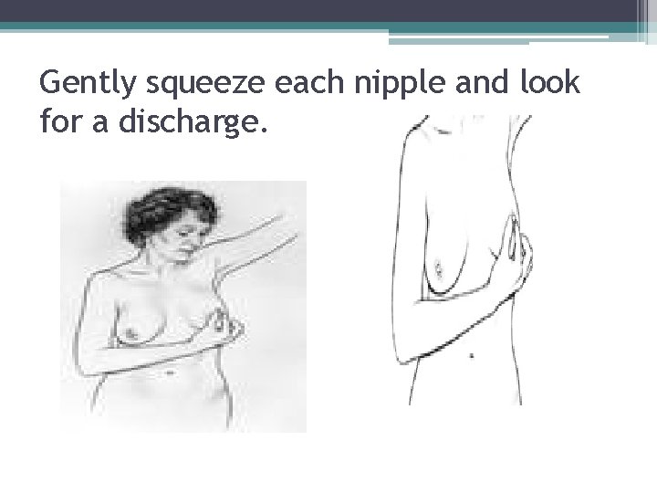 Gently squeeze each nipple and look for a discharge. 