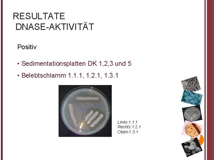 RESULTATE DNASE-AKTIVITÄT Positiv • Sedimentationsplatten DK 1, 2, 3 und 5 • Belebtschlamm 1.