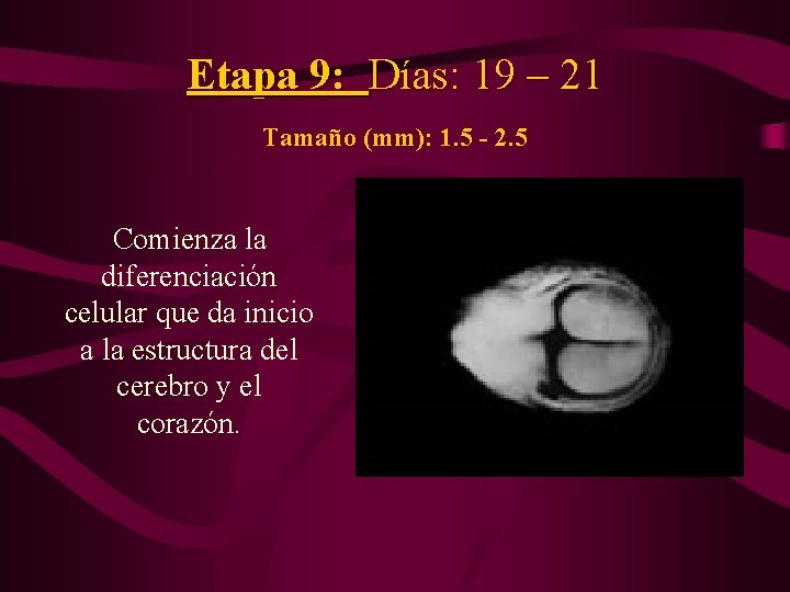 Etapa 9: Días: 19 – 21 Tamaño (mm): 1. 5 - 2. 5 Comienza