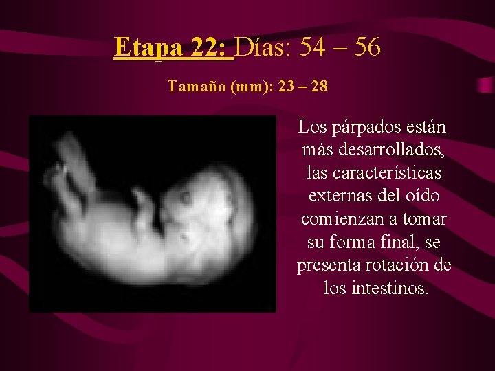 Etapa 22: Días: 54 – 56 Tamaño (mm): 23 – 28 Los párpados están