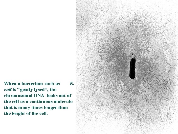 When a bacterium such as E. coli is "gently lysed“, the chromosomal DNA leaks