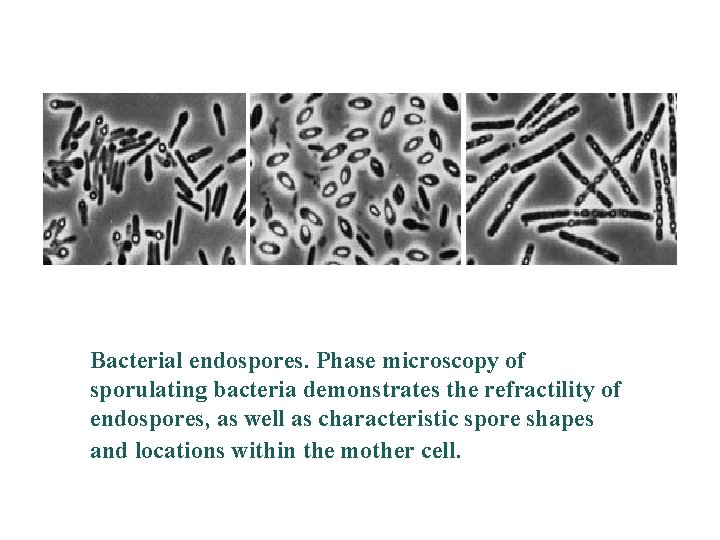 Bacterial endospores. Phase microscopy of sporulating bacteria demonstrates the refractility of endospores, as well