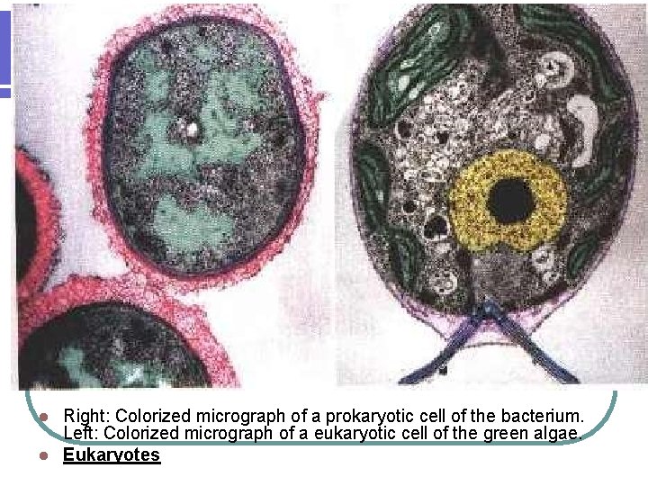 Right: Colorized micrograph of a prokaryotic cell of the bacterium. Left: Colorized micrograph of
