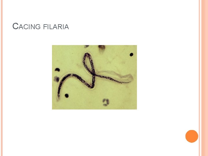 CACING FILARIA 