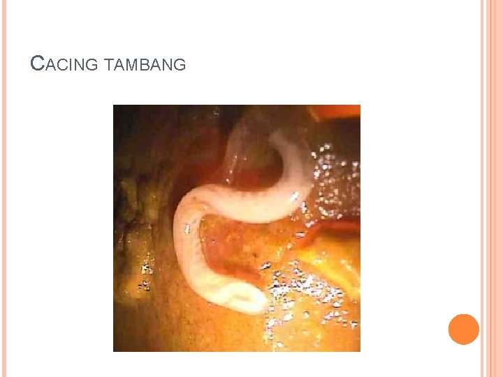 CACING TAMBANG 