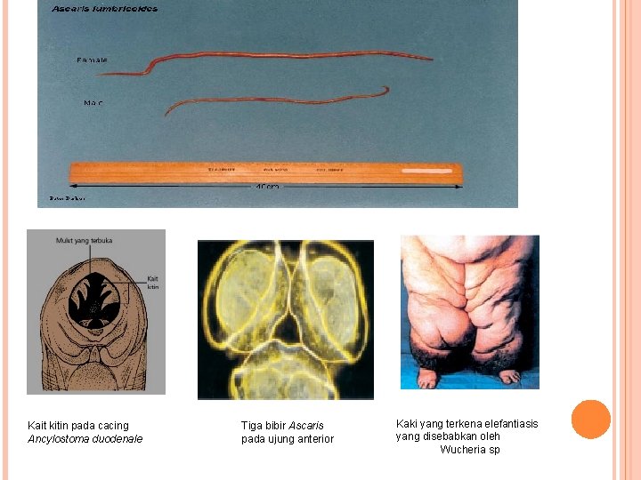 Kait kitin pada cacing Ancylostoma duodenale Tiga bibir Ascaris pada ujung anterior Kaki yang
