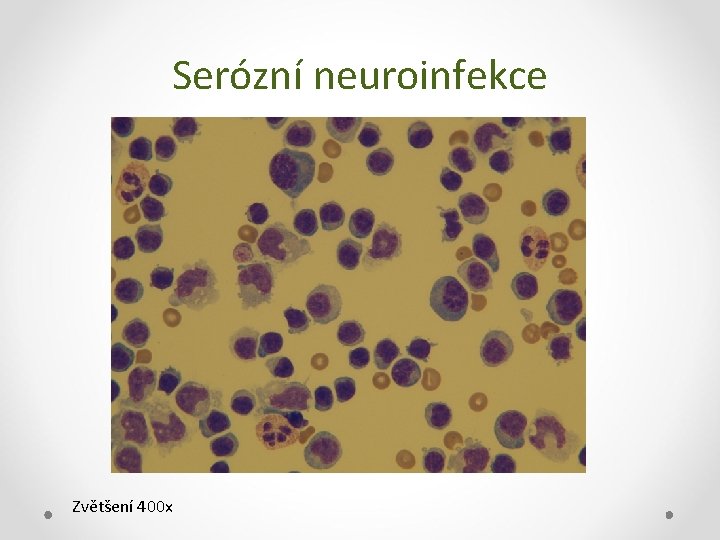 Serózní neuroinfekce Zvětšení 400 x 