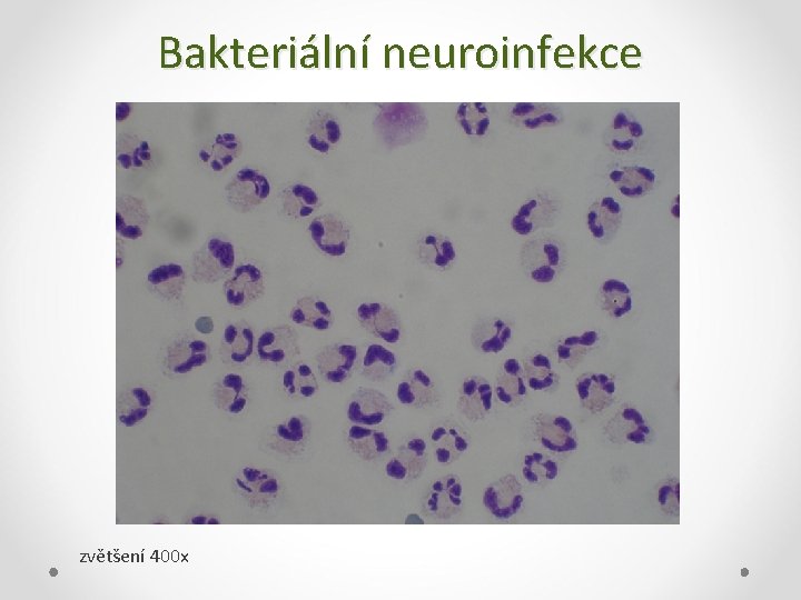 Bakteriální neuroinfekce zvětšení 400 x 