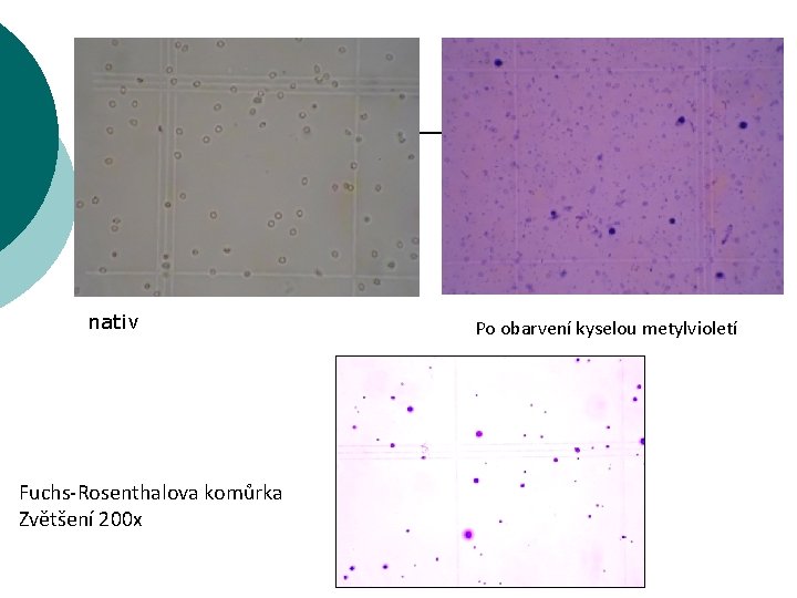 nativ Fuchs-Rosenthalova komůrka Zvětšení 200 x Po obarvení kyselou metylvioletí 