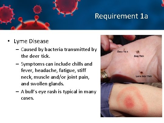 Requirement 1 a • Lyme Disease – Caused by bacteria transmitted by the deer