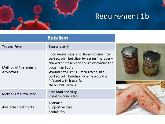 Requirement 1 b Botulism Type or Form Bacteria toxin Method of Transmission or Vectors