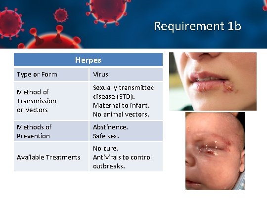 Requirement 1 b Herpes Type or Form Virus Method of Transmission or Vectors Sexually